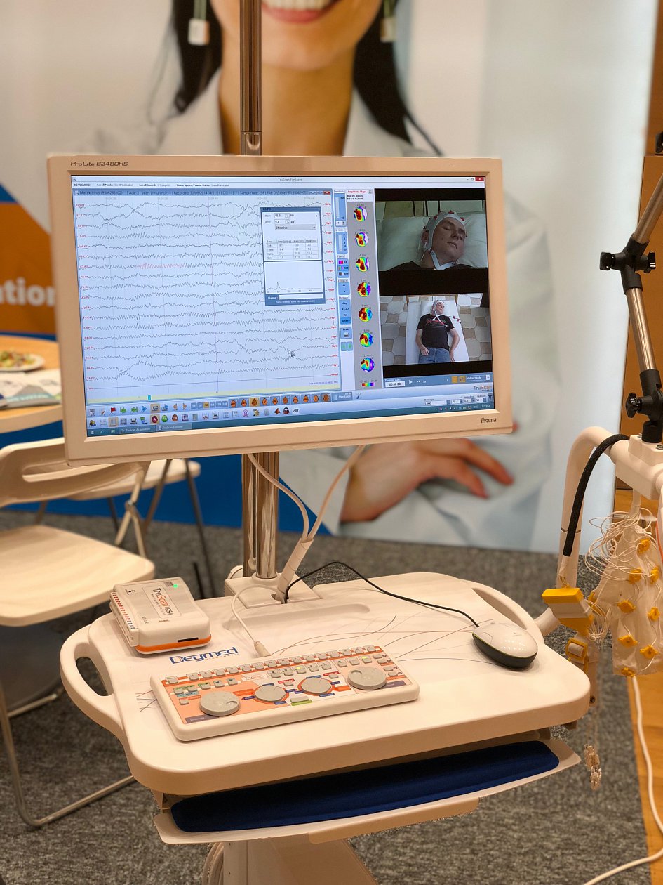 13th European Congress on Epileptology (ECE 2018)